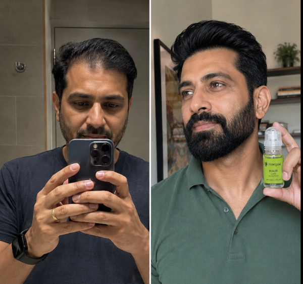 From hair worry to confidence again